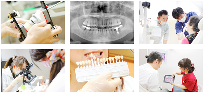その他 シェード レントゲン 検診 カメラ 咬合 