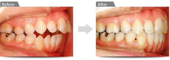 ビフォアー アフター