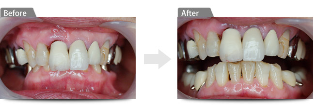 ビフォアー アフター