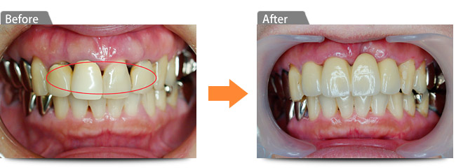 ビフォアー　アフター
