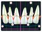 歯の配列・位置