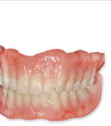 入れ歯のお悩み、これで解消できます。
