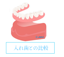 入れ歯との比較