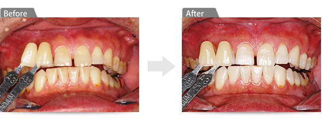 ビフォアー アフター2