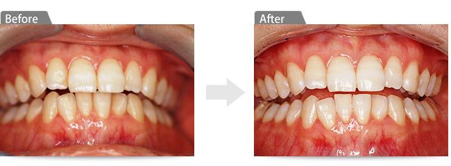 ビフォアー アフター③