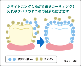 ホワイトニングしながら歯をコーティング