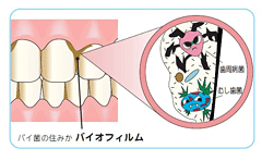 バイオフィルム