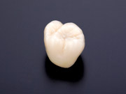 審美セラミック歯科